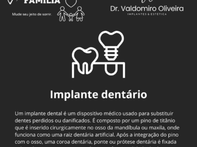 Implantes e facetas