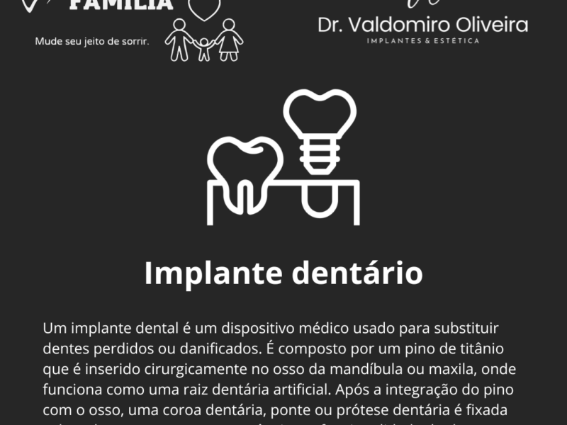 Implantes e facetas