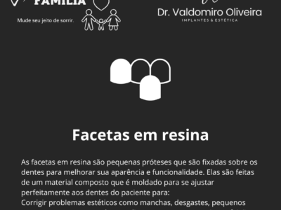 Implantes e facetas