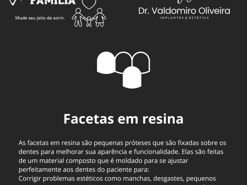 Implantes e facetas